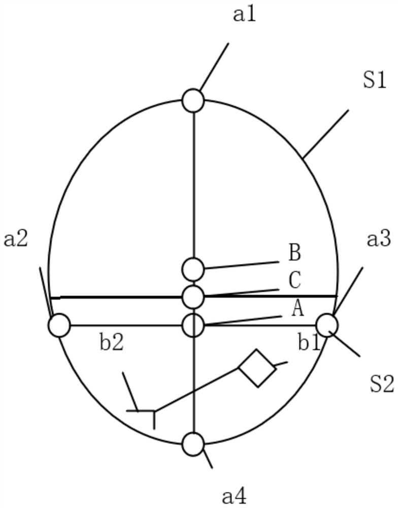 Middle pelvis plane fetal headrest transverse position non-uniform inclination potential identification method