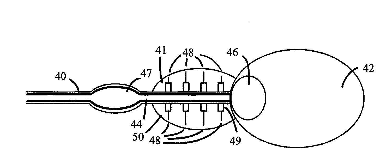 Catheter for Treating Tissue with Non-Thermal Ablation