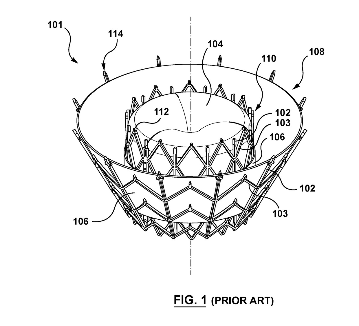 Valve delivery system having an integral displacement component for managing chordae tendineae in situ and methods of use thereof