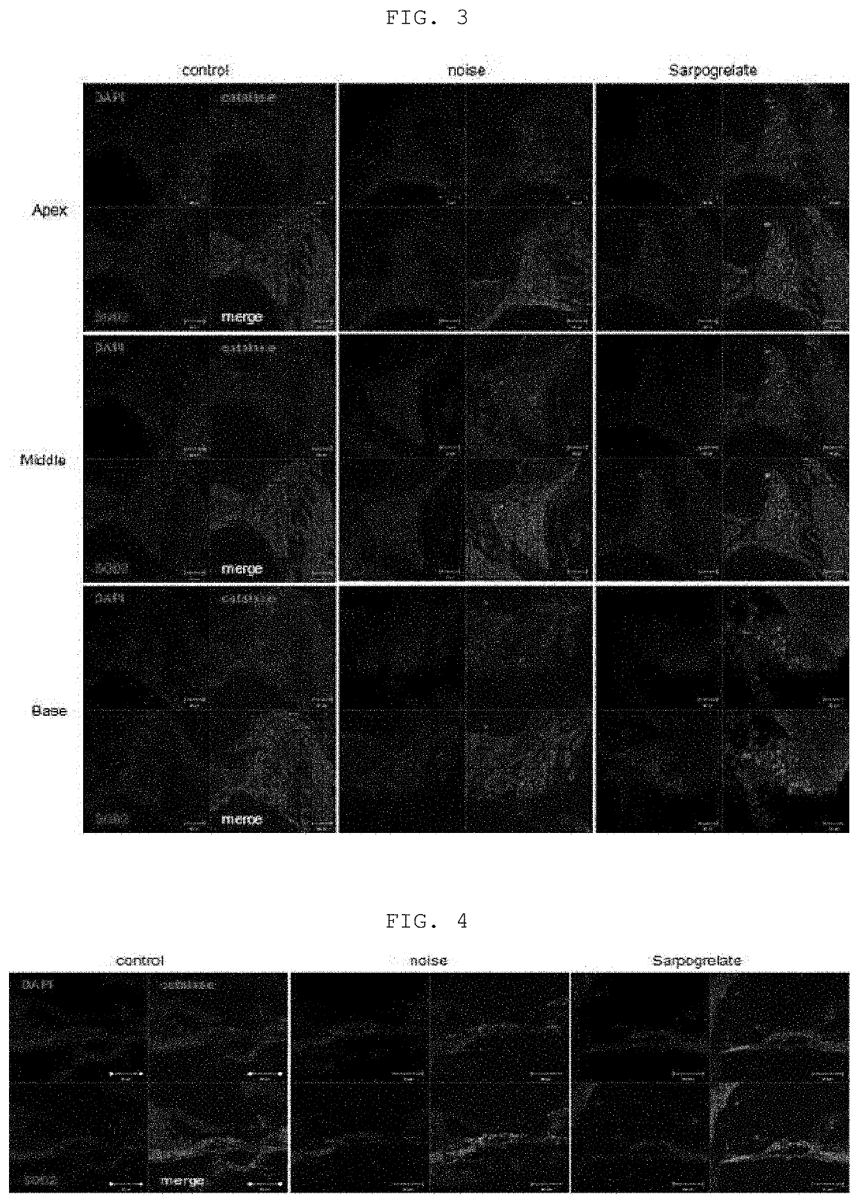 Composition, containing sarpogrelate as active ingredient, for preventing or treating sensorineural hearing loss