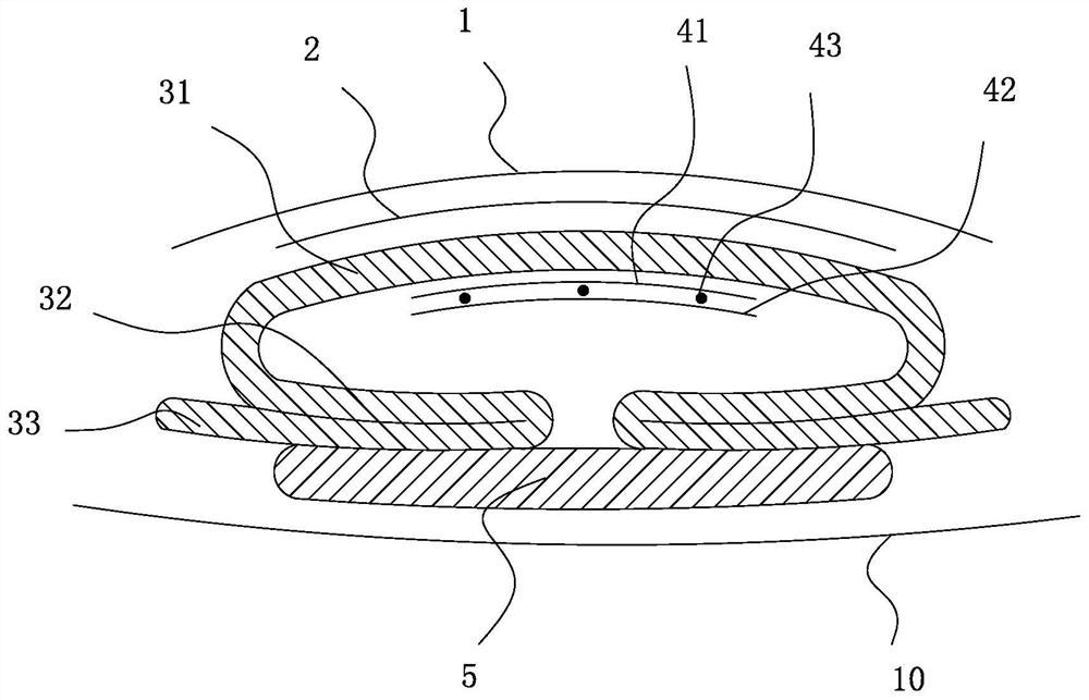 Preparation method of low-back-osmosis absorption article