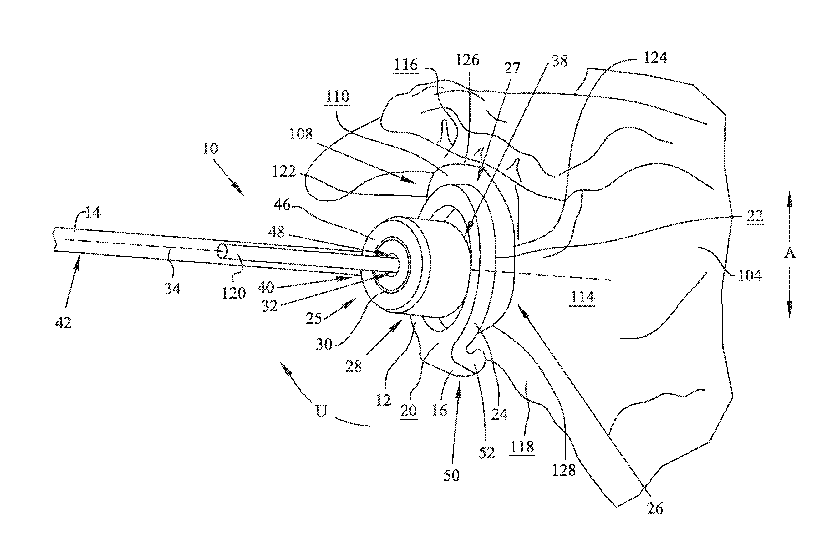 Glenoid alignment tool