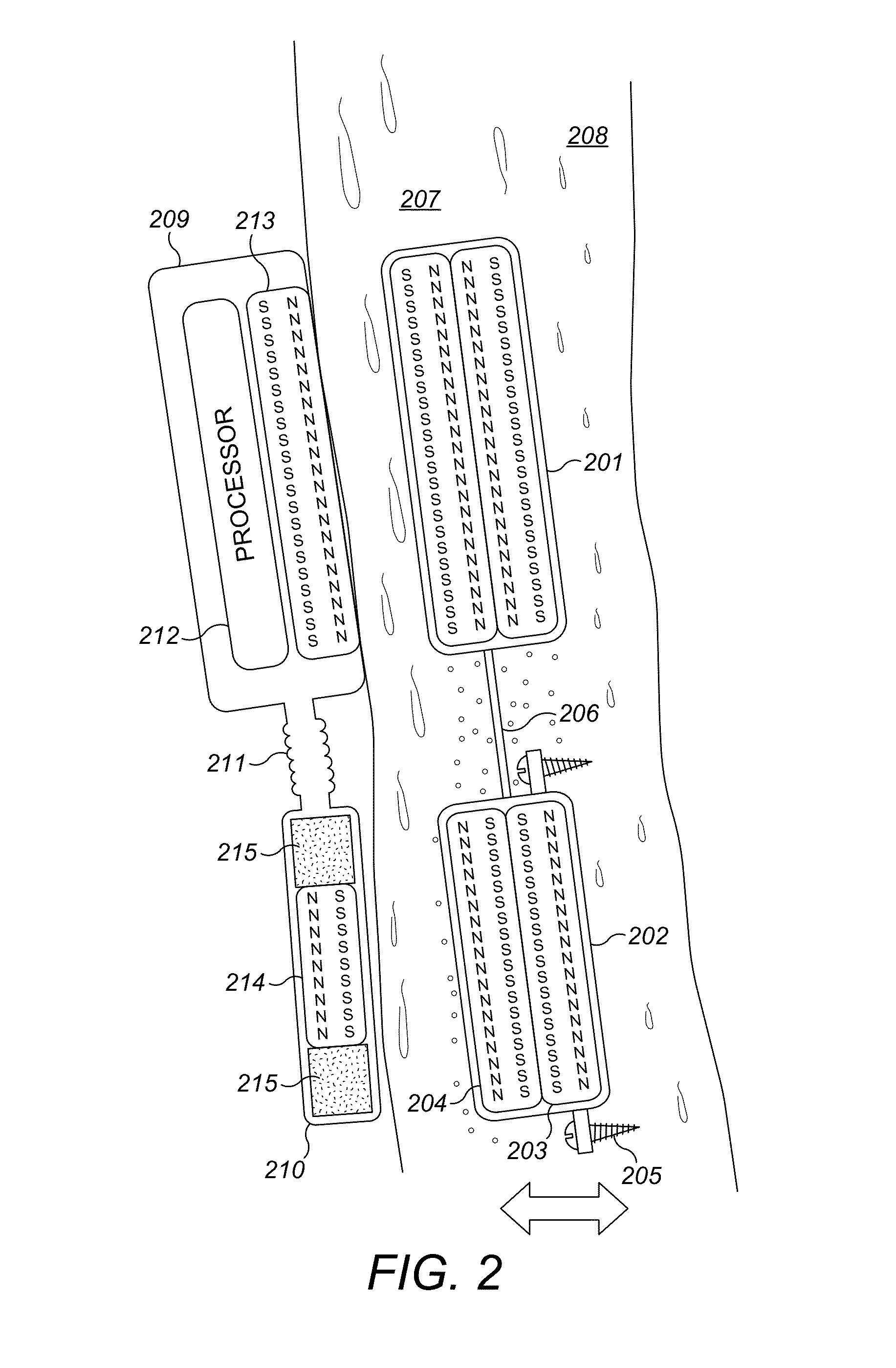 Magnet arrangement for bone conduction hearing implant