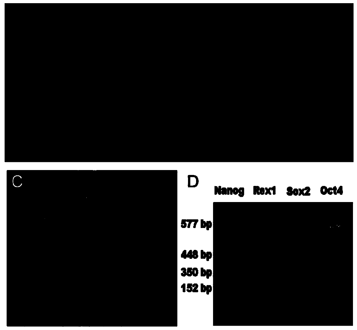 Preparation method of neural stem cells and glutamatergic neurons in cerebral cortex