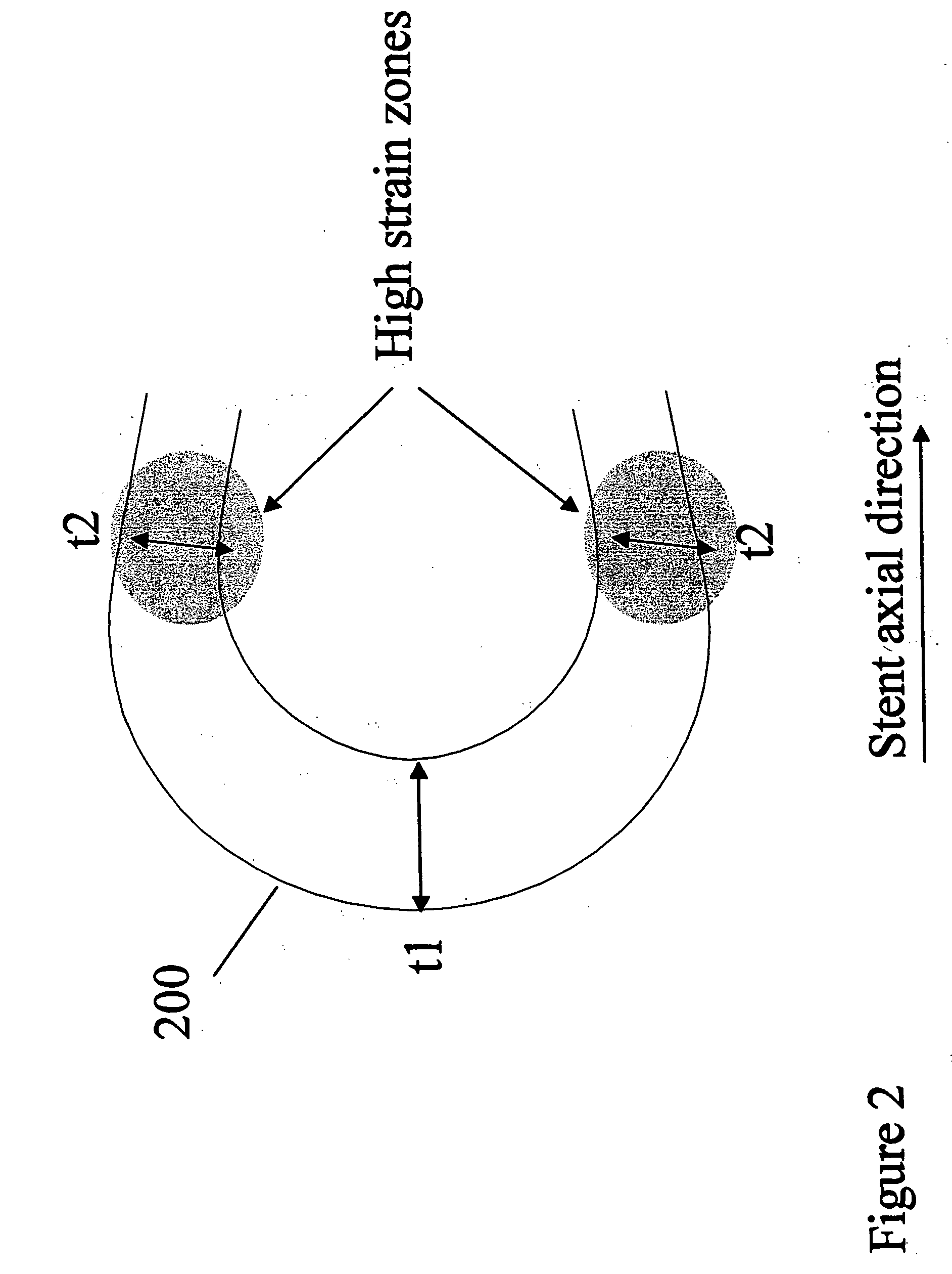 Polymeric stent having modified molecular structures in the flexible connectors and the radial struts of the hoops