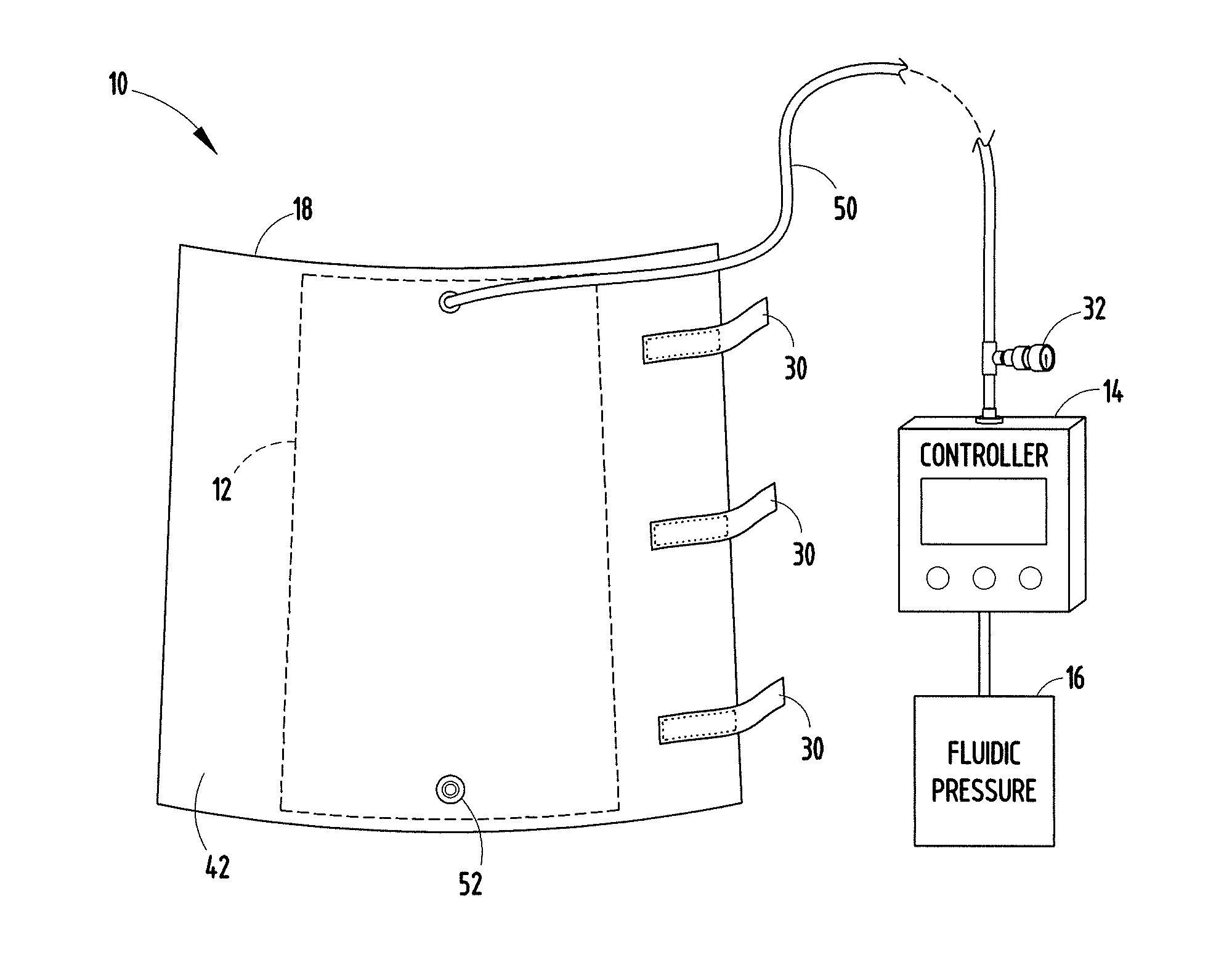 Compression device and control system for applying pressure to a limb of a living being