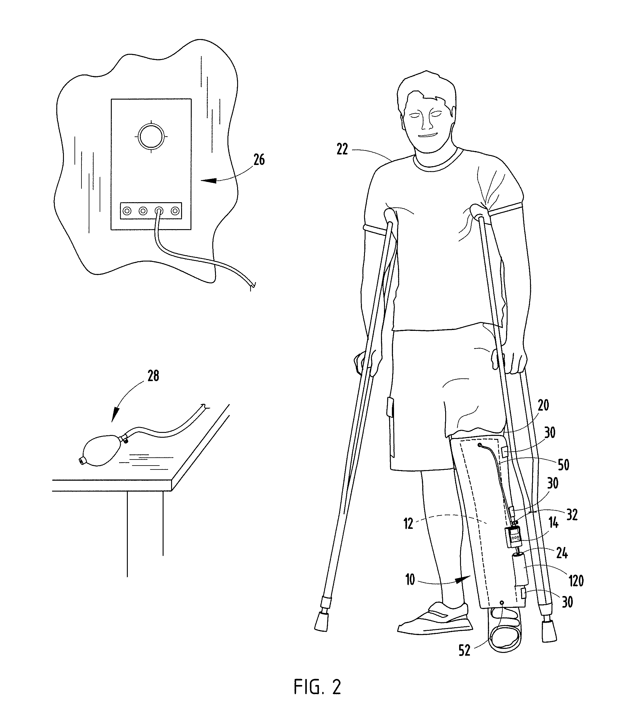 Compression device and control system for applying pressure to a limb of a living being