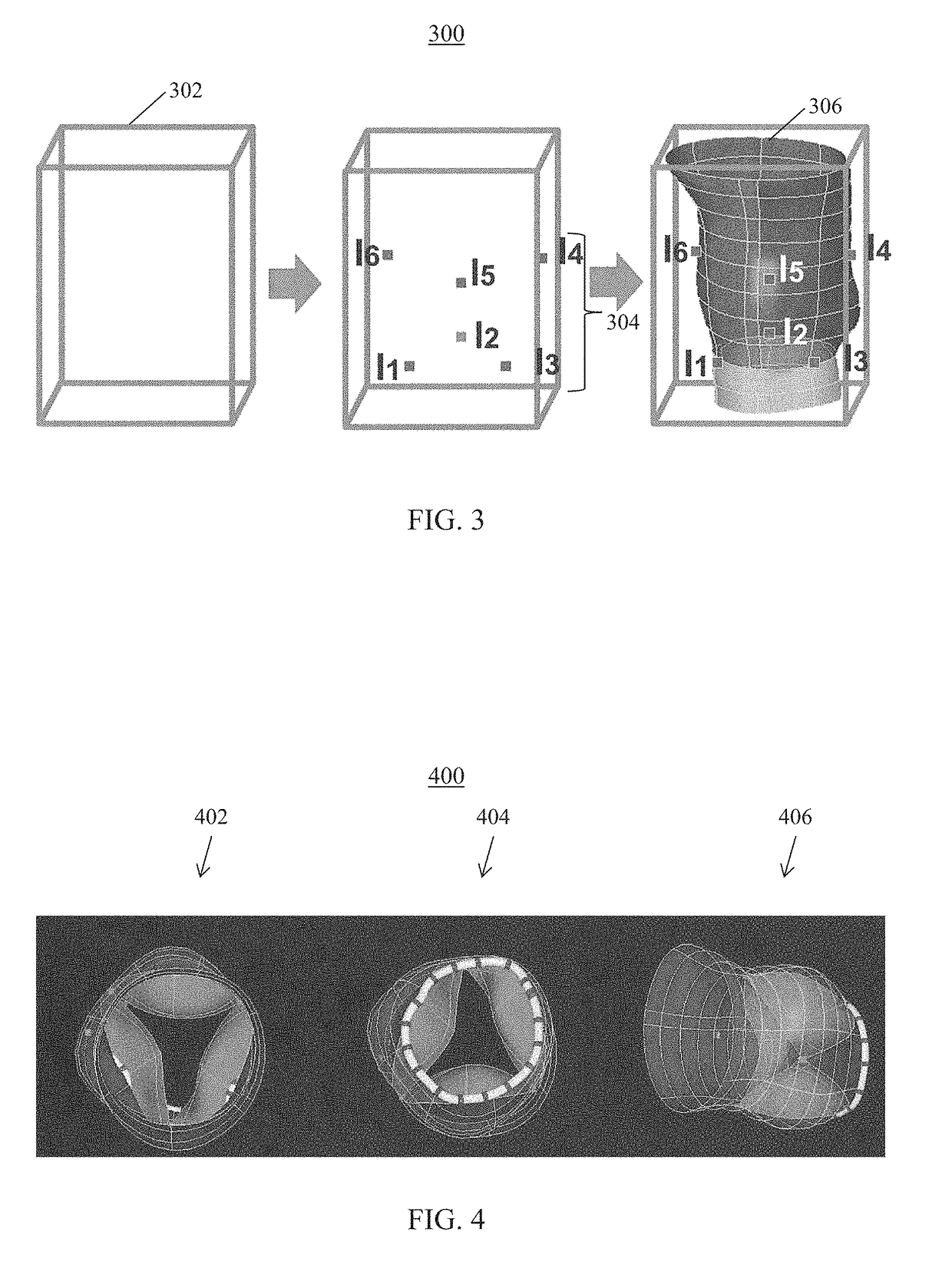 Systems and method for computation and visualization of segmentation uncertainty in medical images