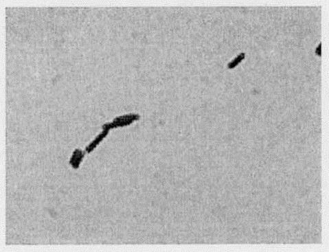 Lactobacillus fermentum strain and application thereof