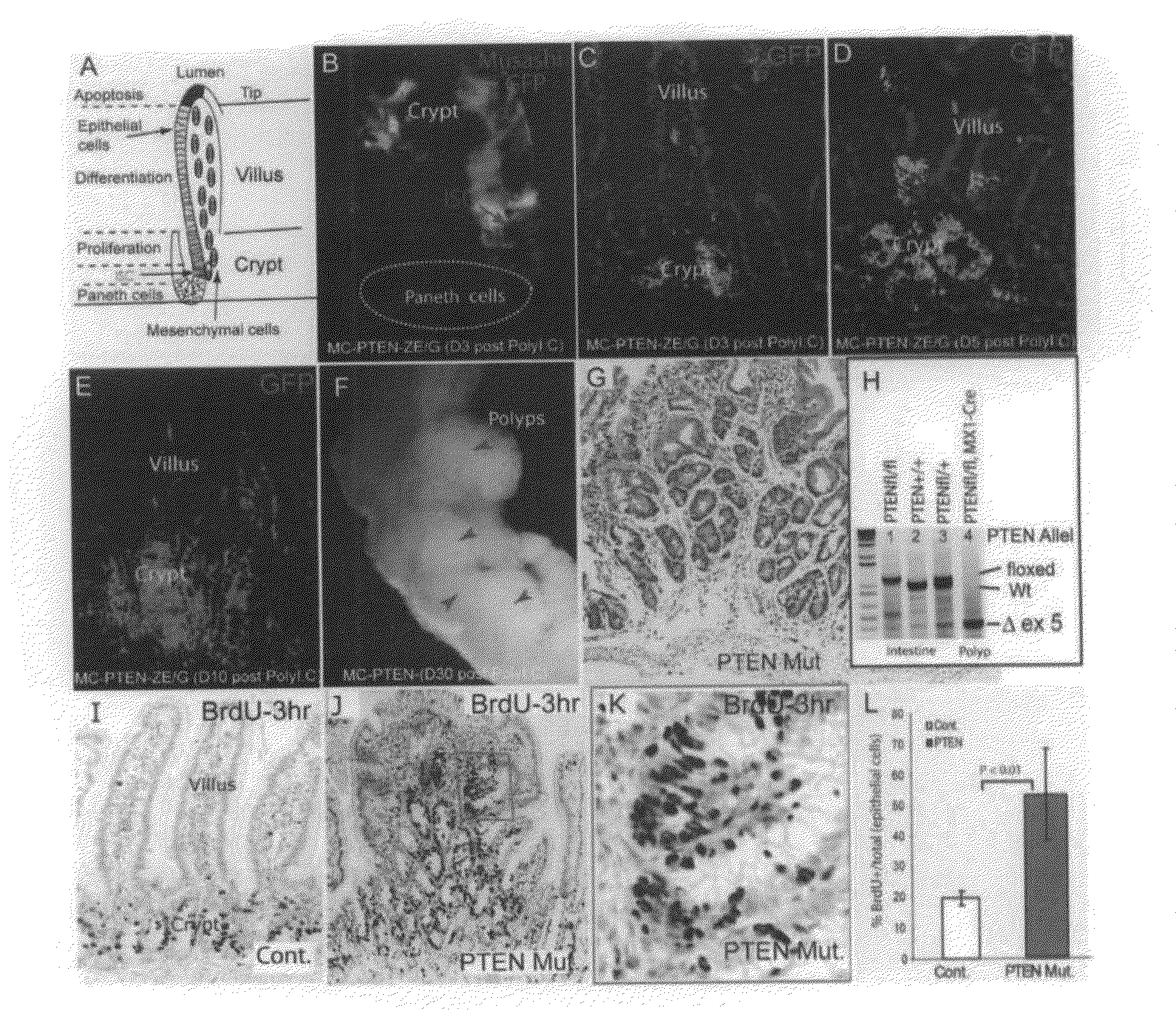 PTEN/Akt methods and compositions relating to BMP