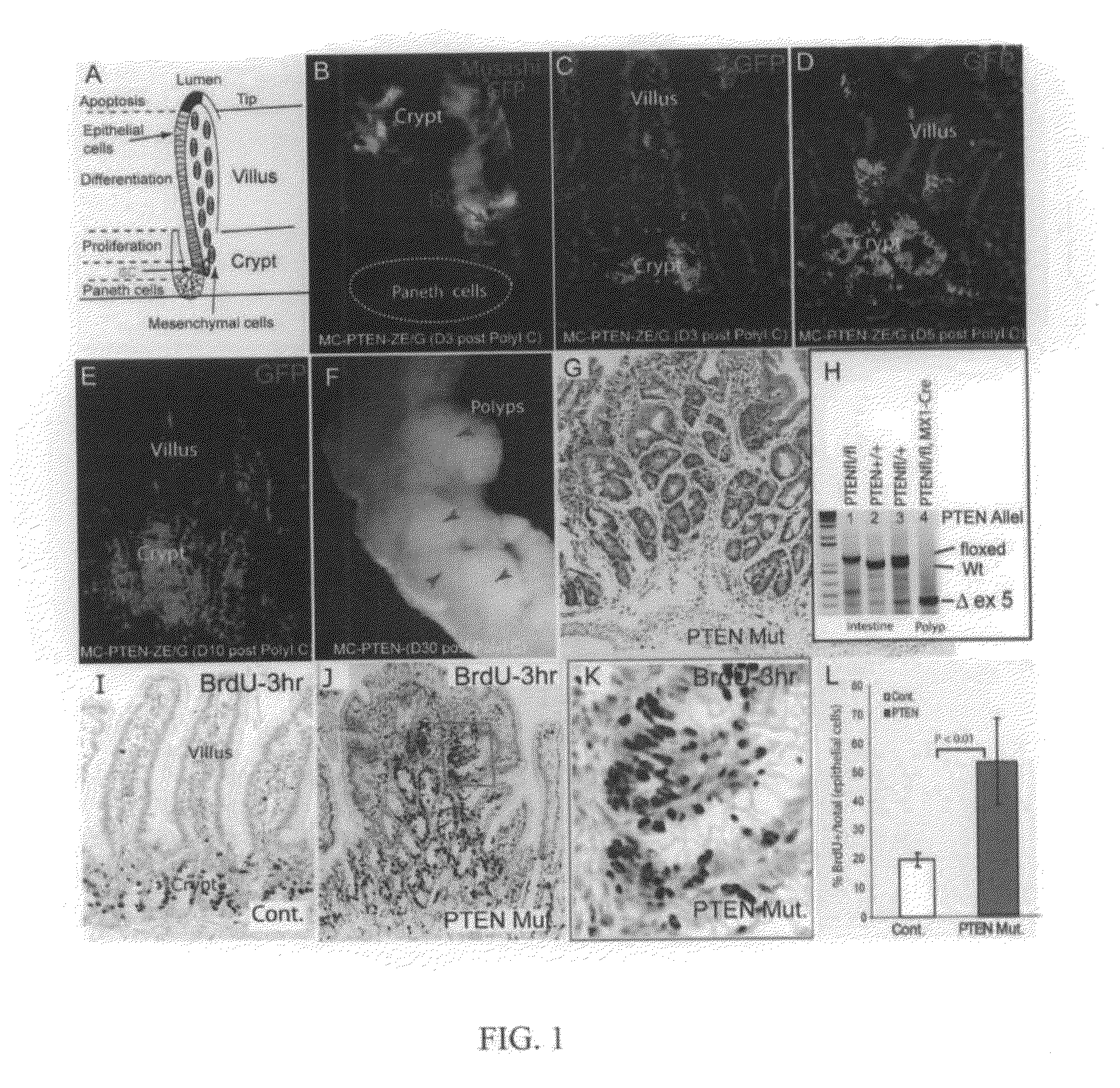 PTEN/Akt methods and compositions relating to BMP