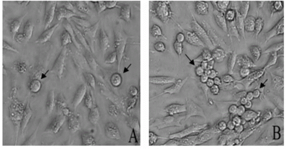 Erythroculter ilishaeformis spermatogonia stem cell separation and culture method