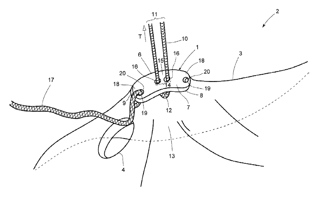 Device for arthroscopic use, and method of diagnosis or treatment of joint ailments using said device