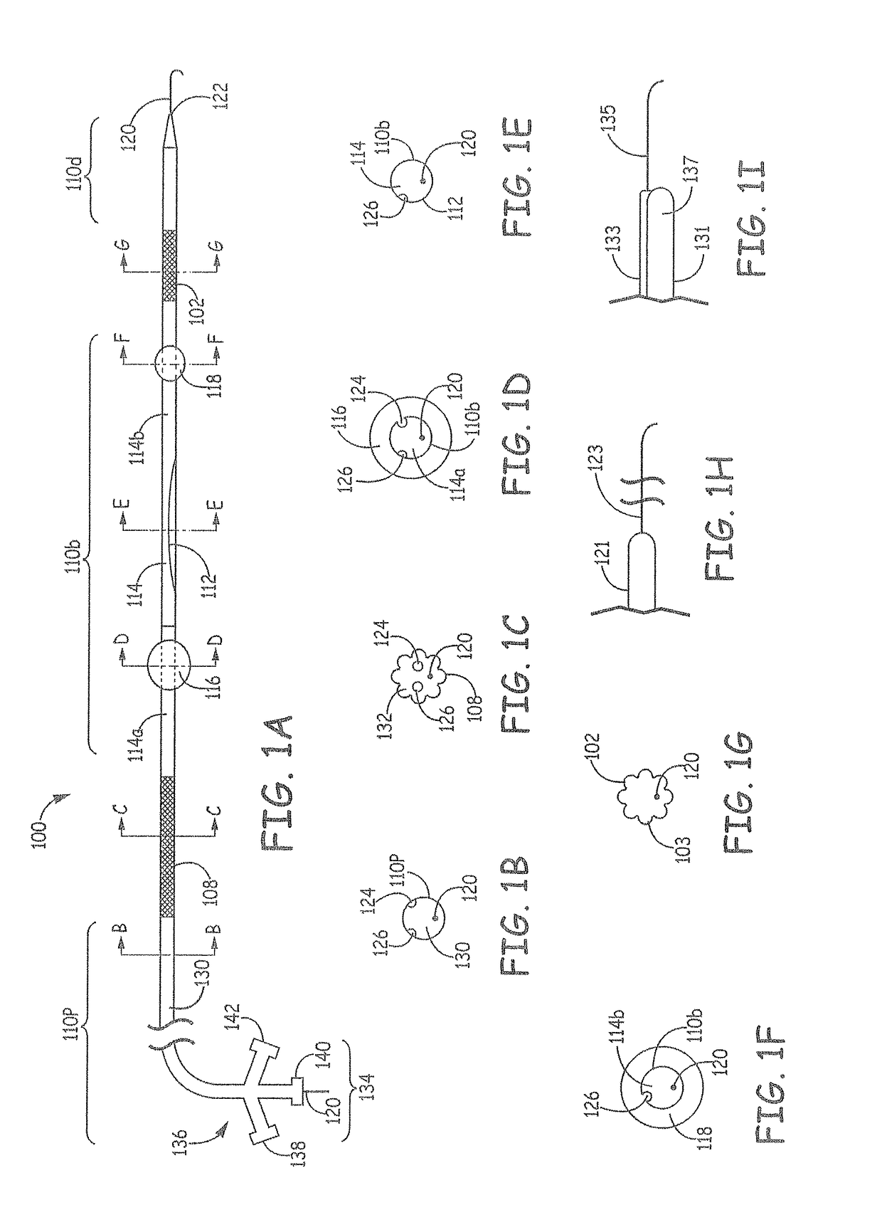 Aortic arch filtration system for carotid artery protection