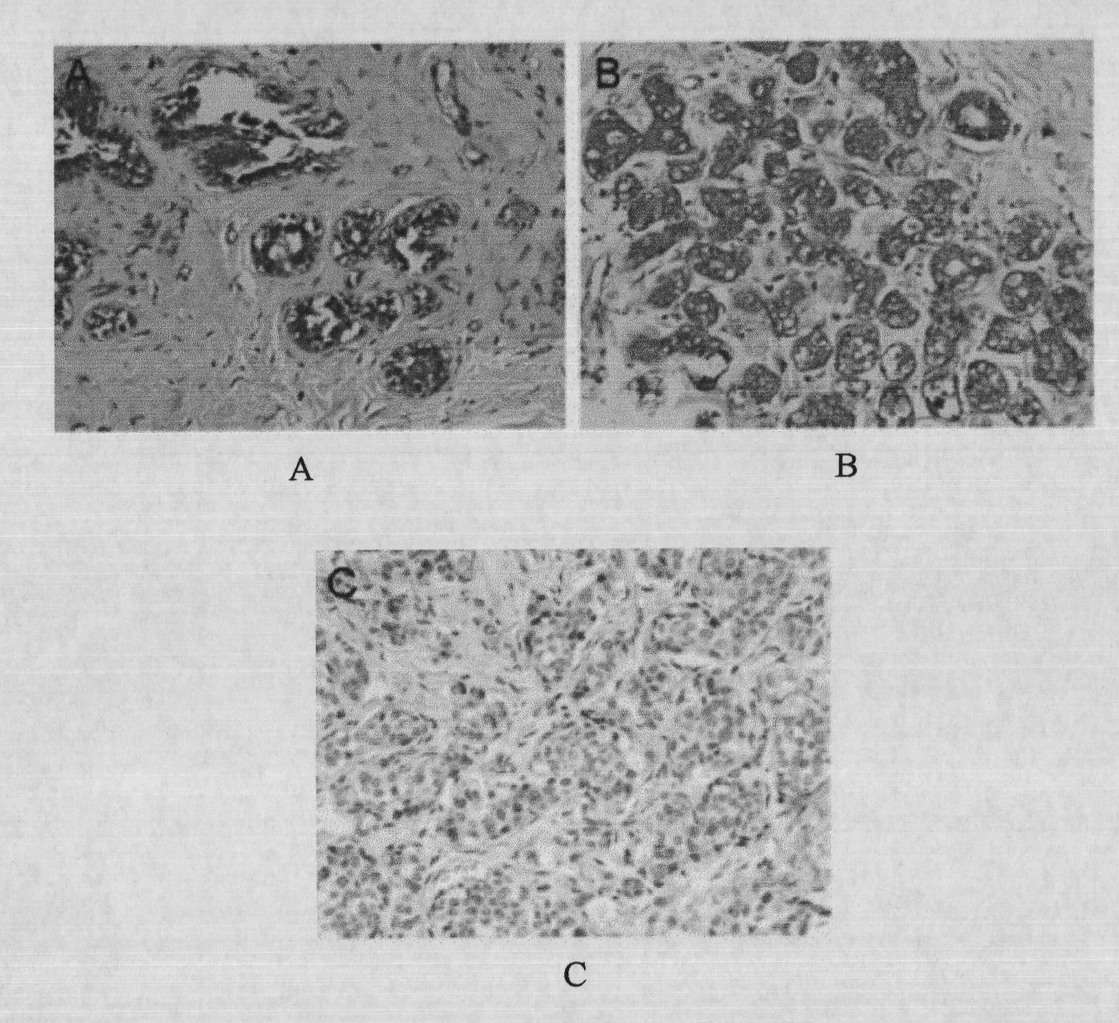 Humanized breast cancer antigen and antibody thereof