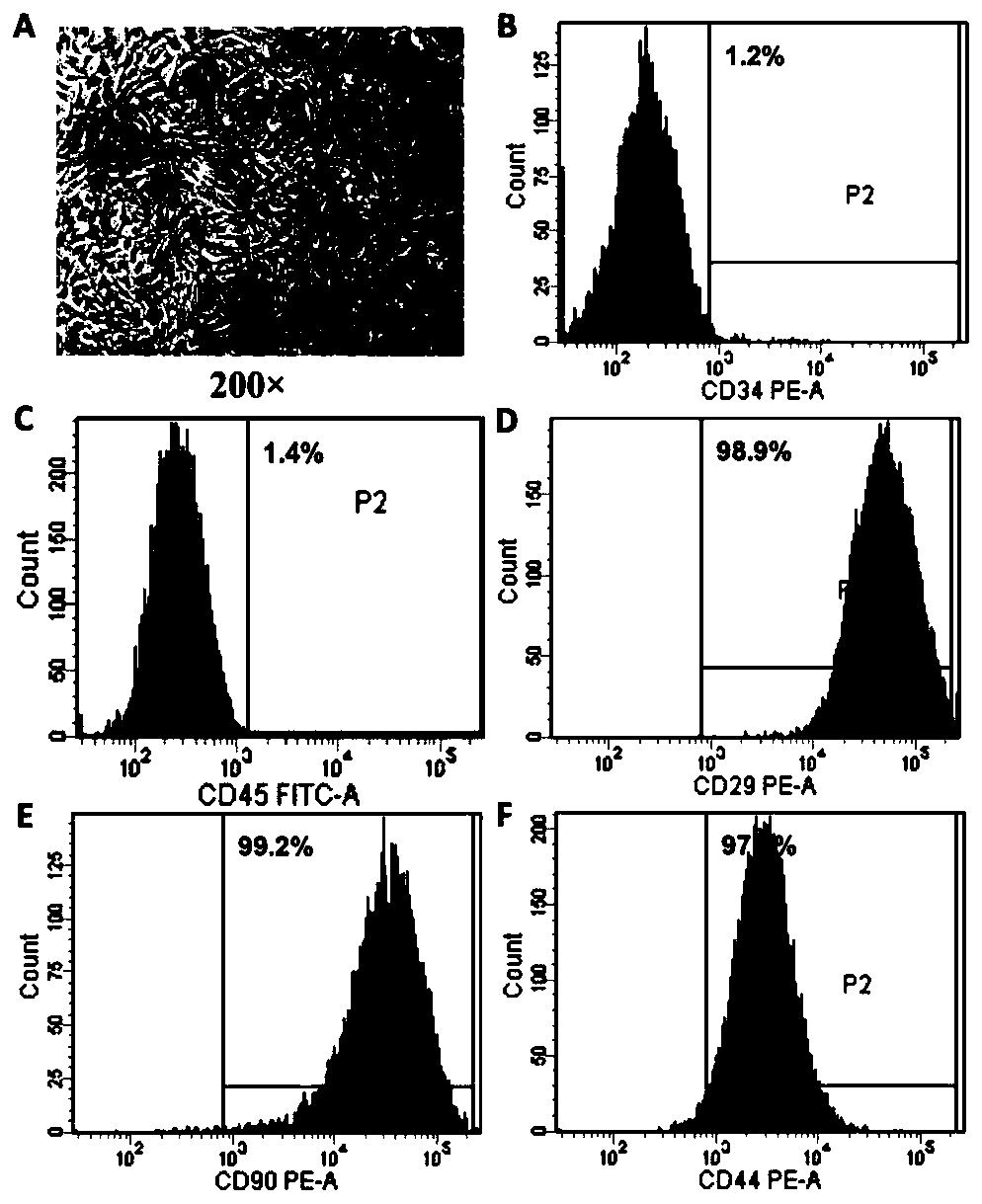 Recombinant MSCs (mesenchymal stem cells) as well as preparation method and application thereof in preparation of drug for treating ALF (acute liver failure)