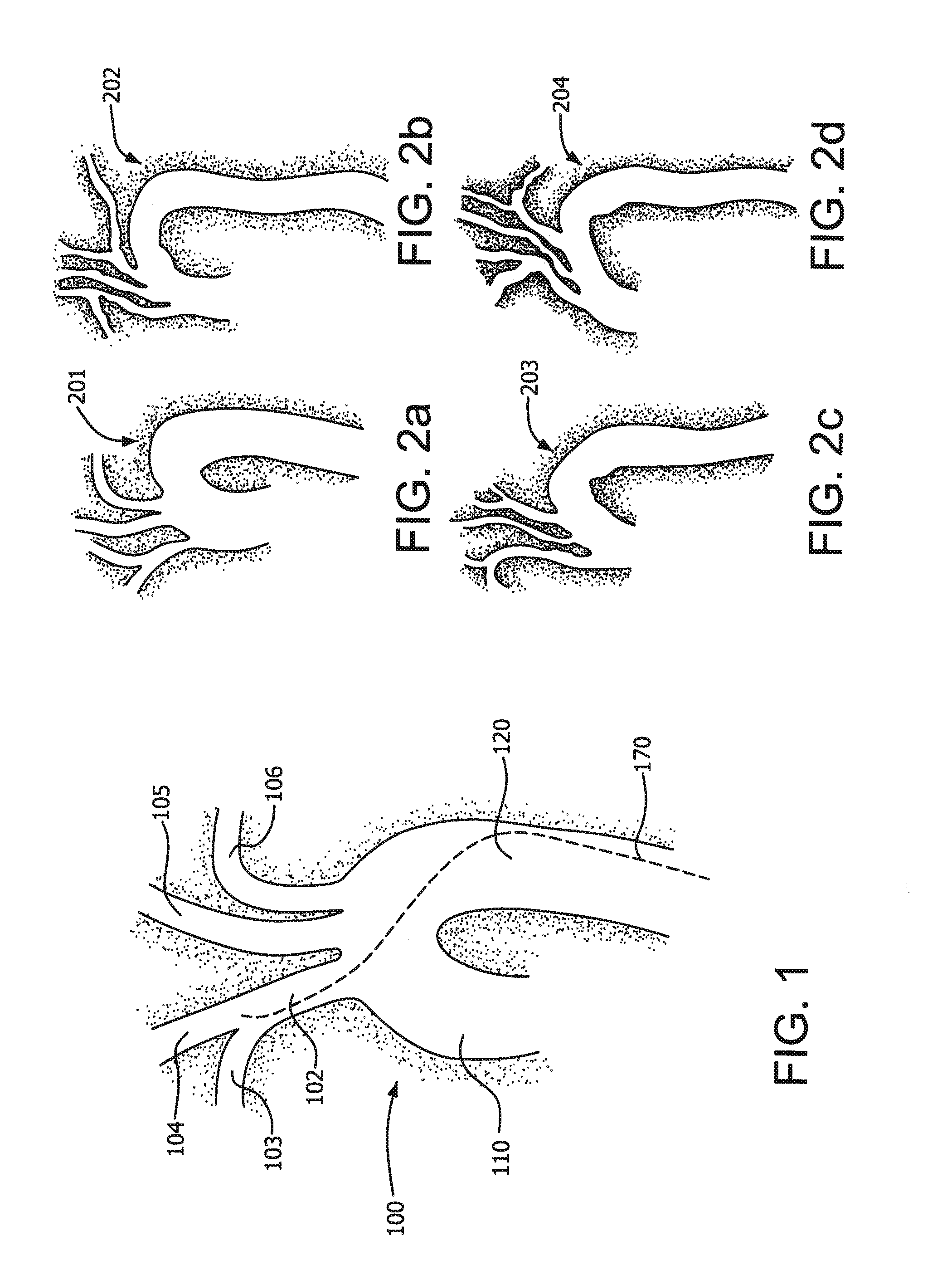 Methods and apparatus for an adjustable stiffness catheter