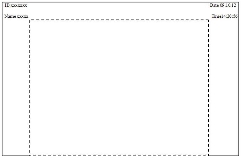 Method and system for generating DICOMDIR file