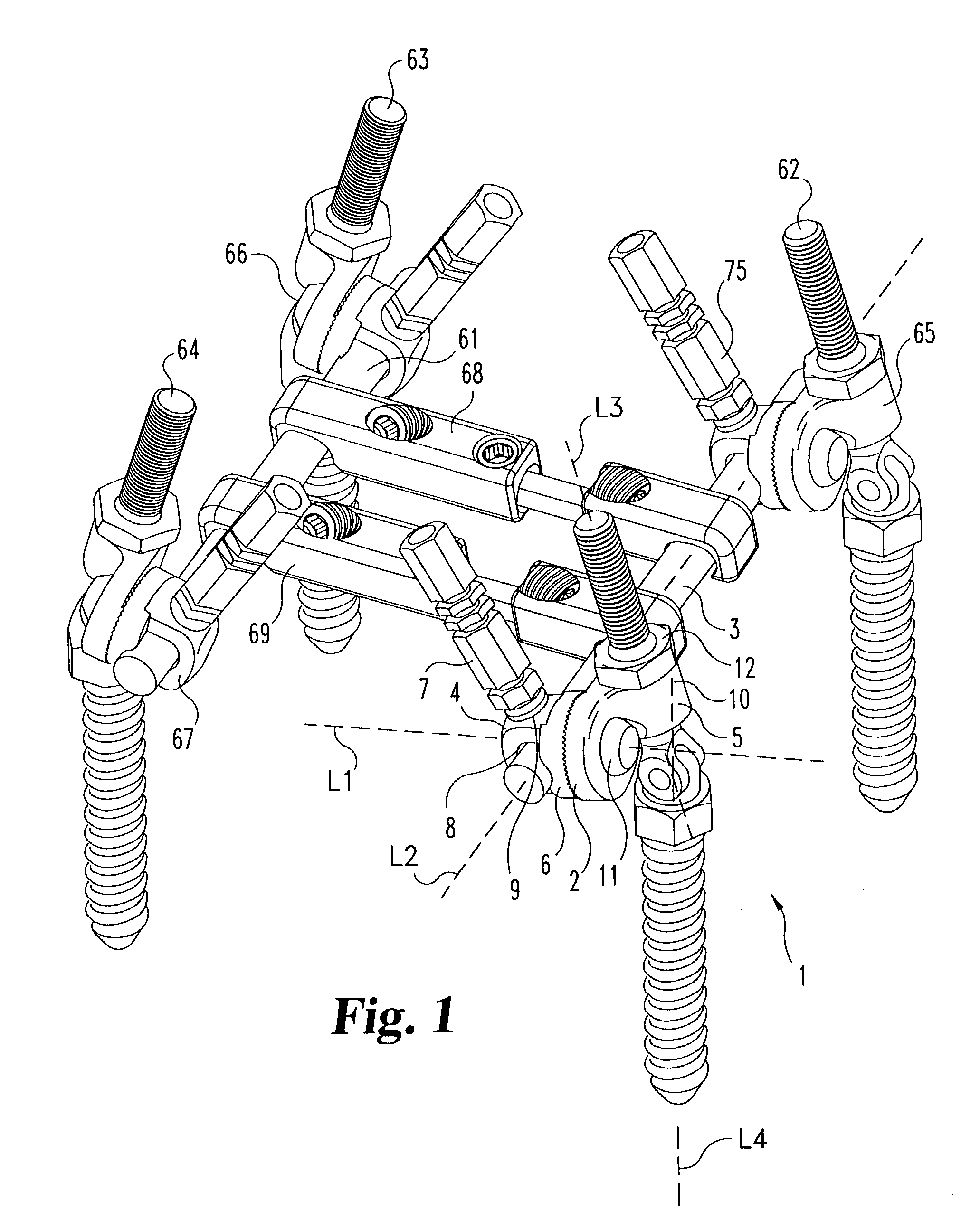 Multidirectional pivoting bone screw and fixation system