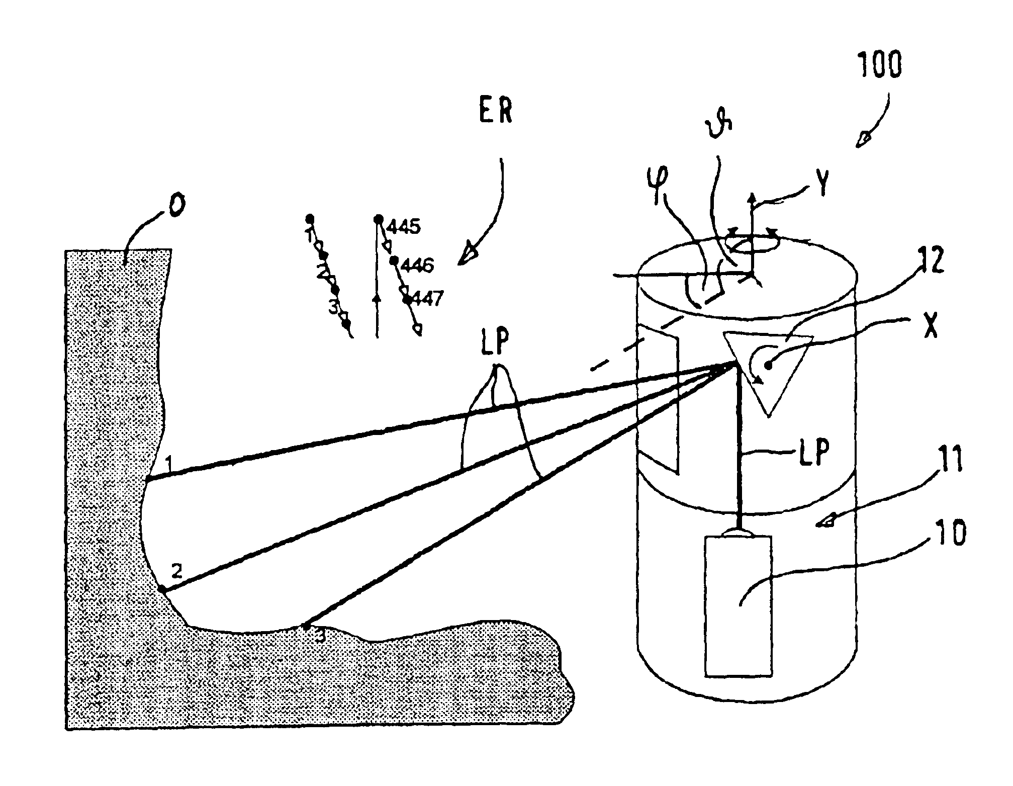 Measurement of the wear of the fireproof lining of a metallurgical vessel