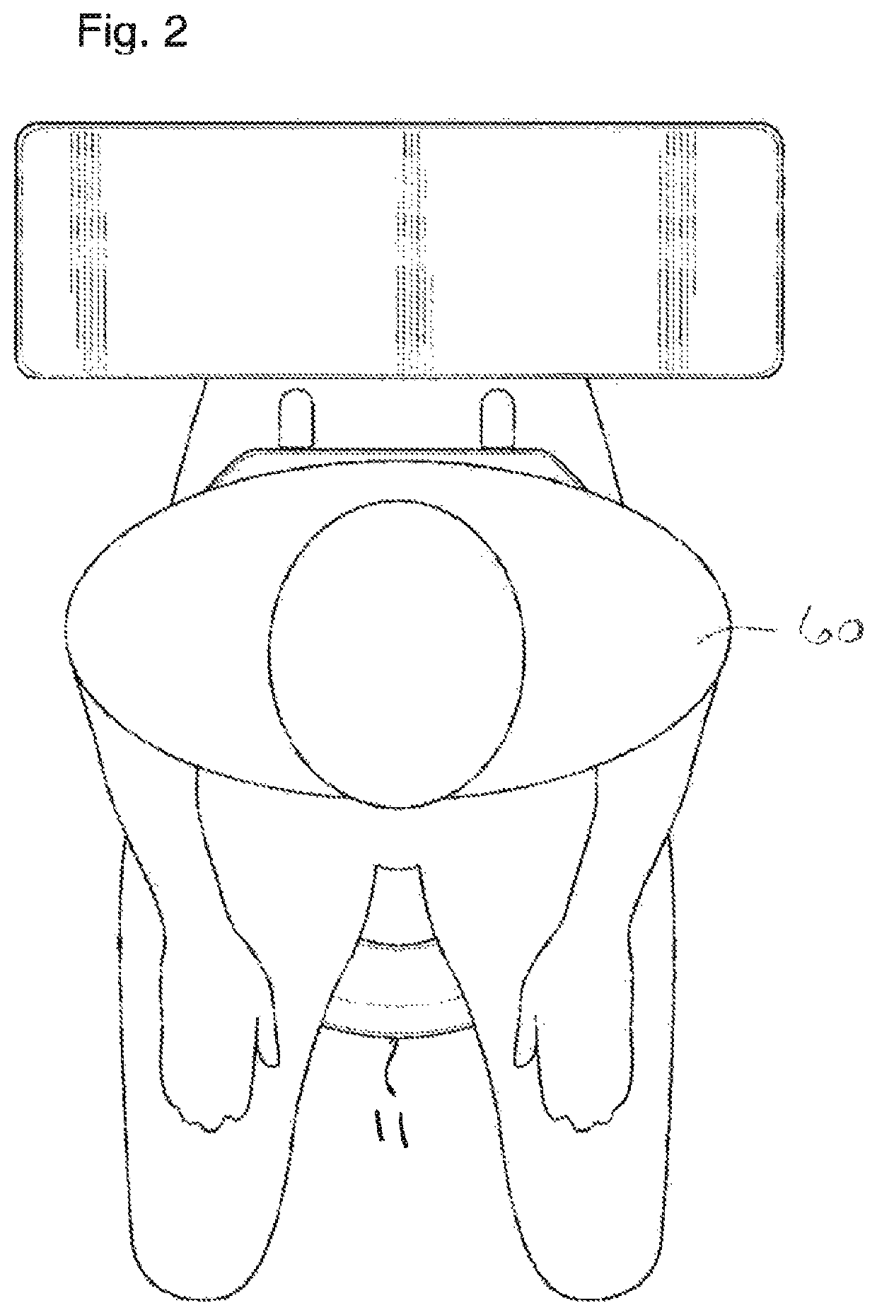 Urine deflector