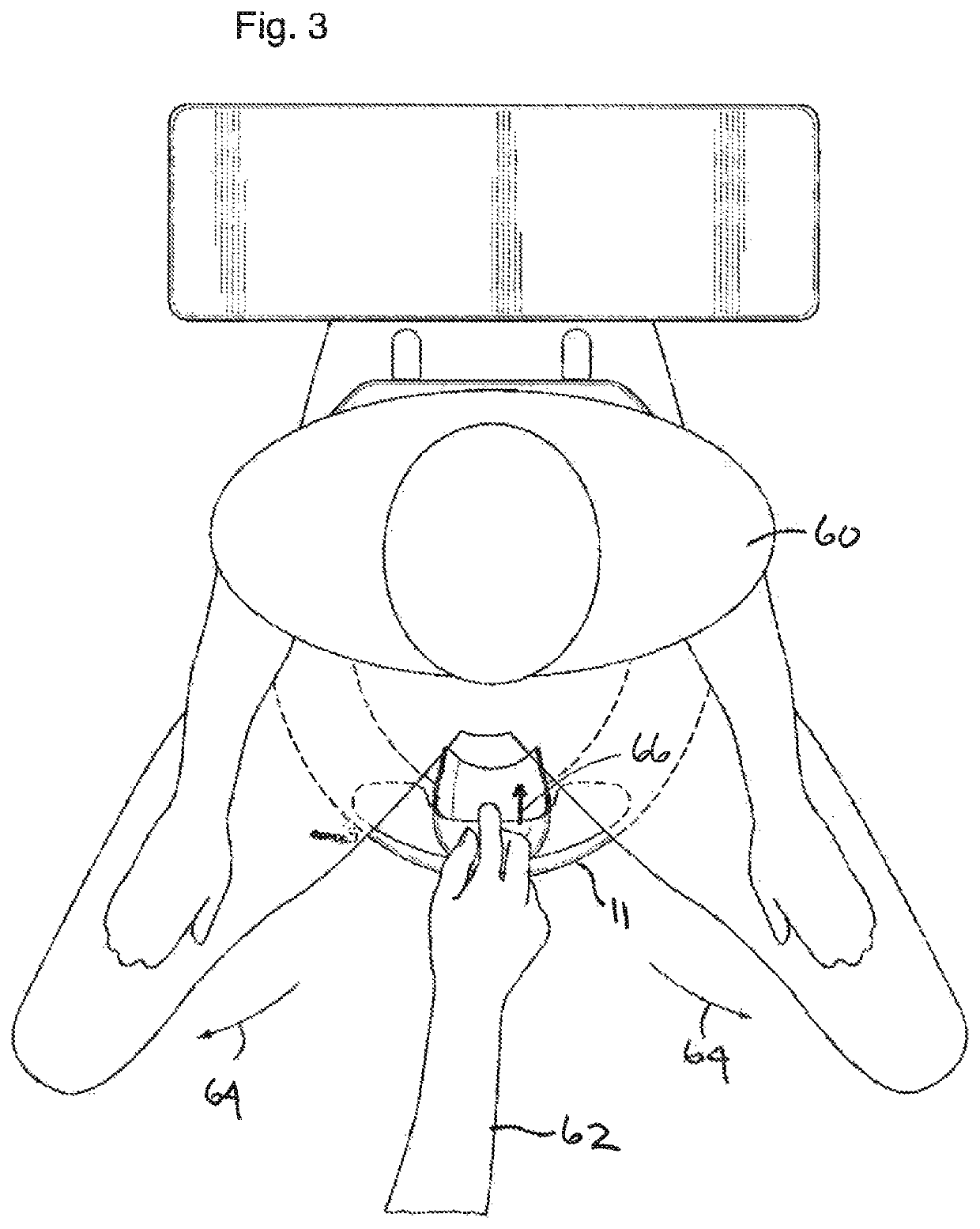 Urine deflector