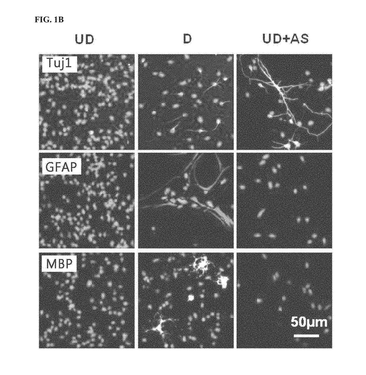 Composition for inducing differentiation of multipotent neural stem cells into dopaminergic neurons and method for inducing differentiation of multipotent neural stem cells into dopaminergic neurons by using the same