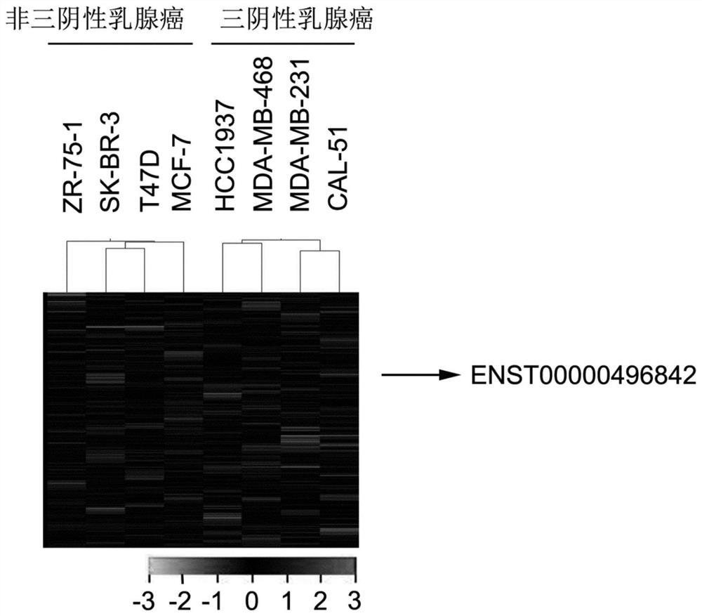 Application of long-chain non-coding RNA molecule in diagnosis and/or treatment of triple-negative breast cancer