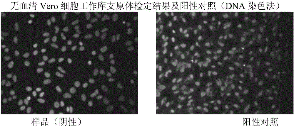 Method for preparing rotavirus vaccine stock solution by using serum-free Vero cells and serum-free rotavirus vaccine product