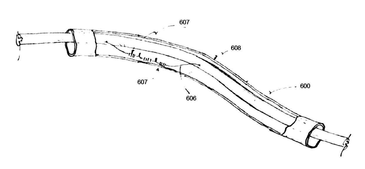 Devices and methods for reducing intrathoracic pressure