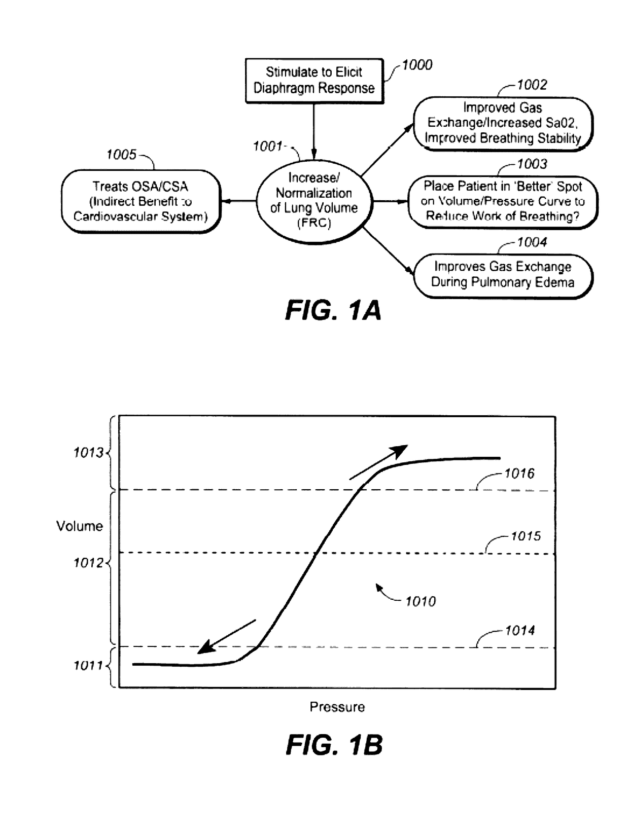 Devices and methods for reducing intrathoracic pressure