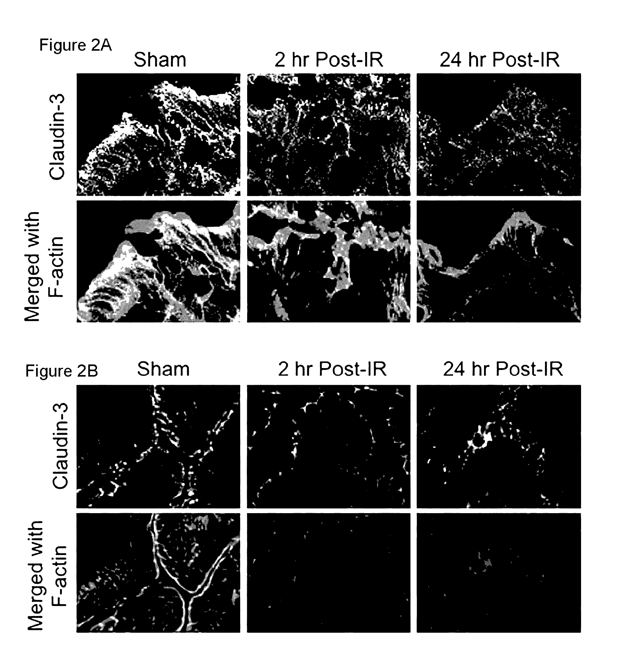 Compositions and methods for protecting colonic epithelial barrier function