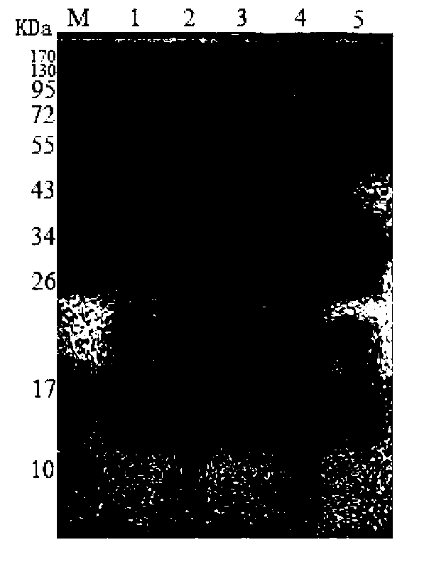 Brucella B cell epitope and monoclonal antibody and application thereof