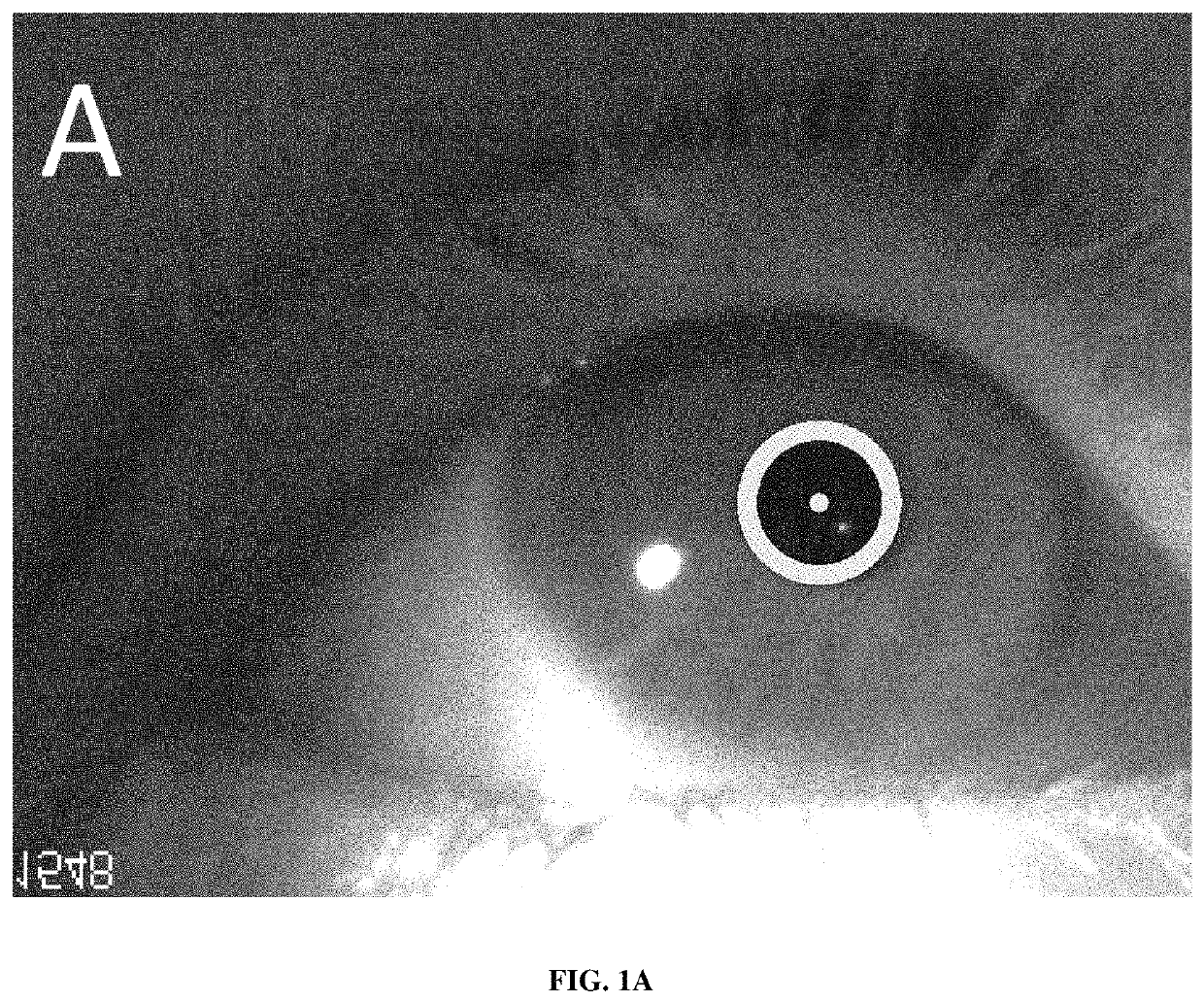 System for traumatic brain injury detection using oculomotor tests