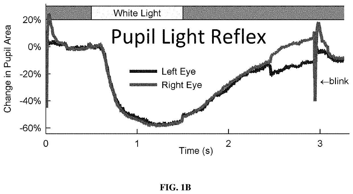 System for traumatic brain injury detection using oculomotor tests