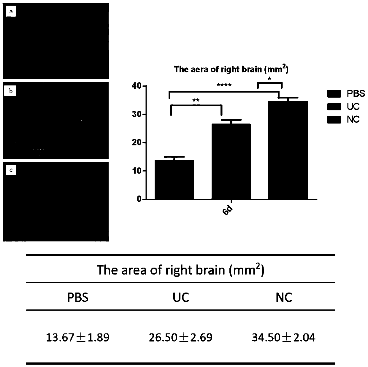 Neural crest cell culture fluid, preparation method of neural crest mesenchymal stem cells and application of neural crest mesenchymal stem cells