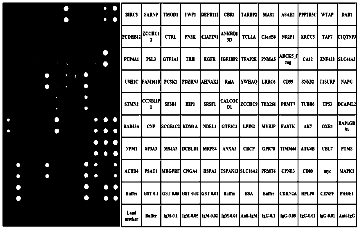 Autoantibody 7-AAb detection panel for hepatocellular carcinoma and application of autoantibody 7-AAb detection panel