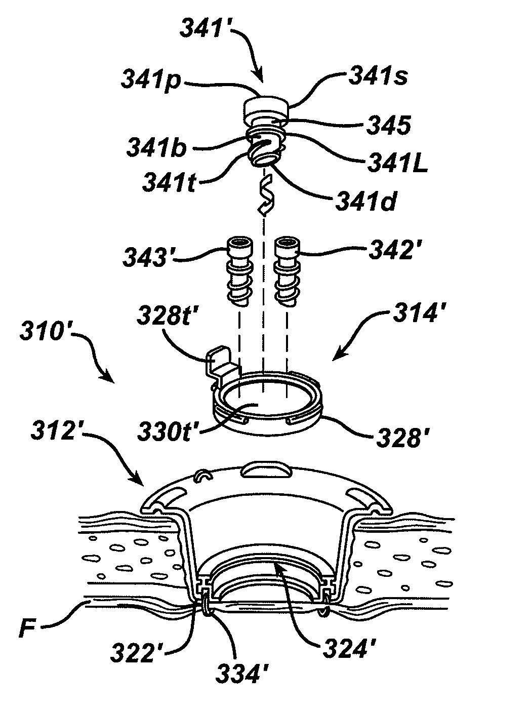 Methods and devices for accessing a body cavity using a surgical access device with modular seal components