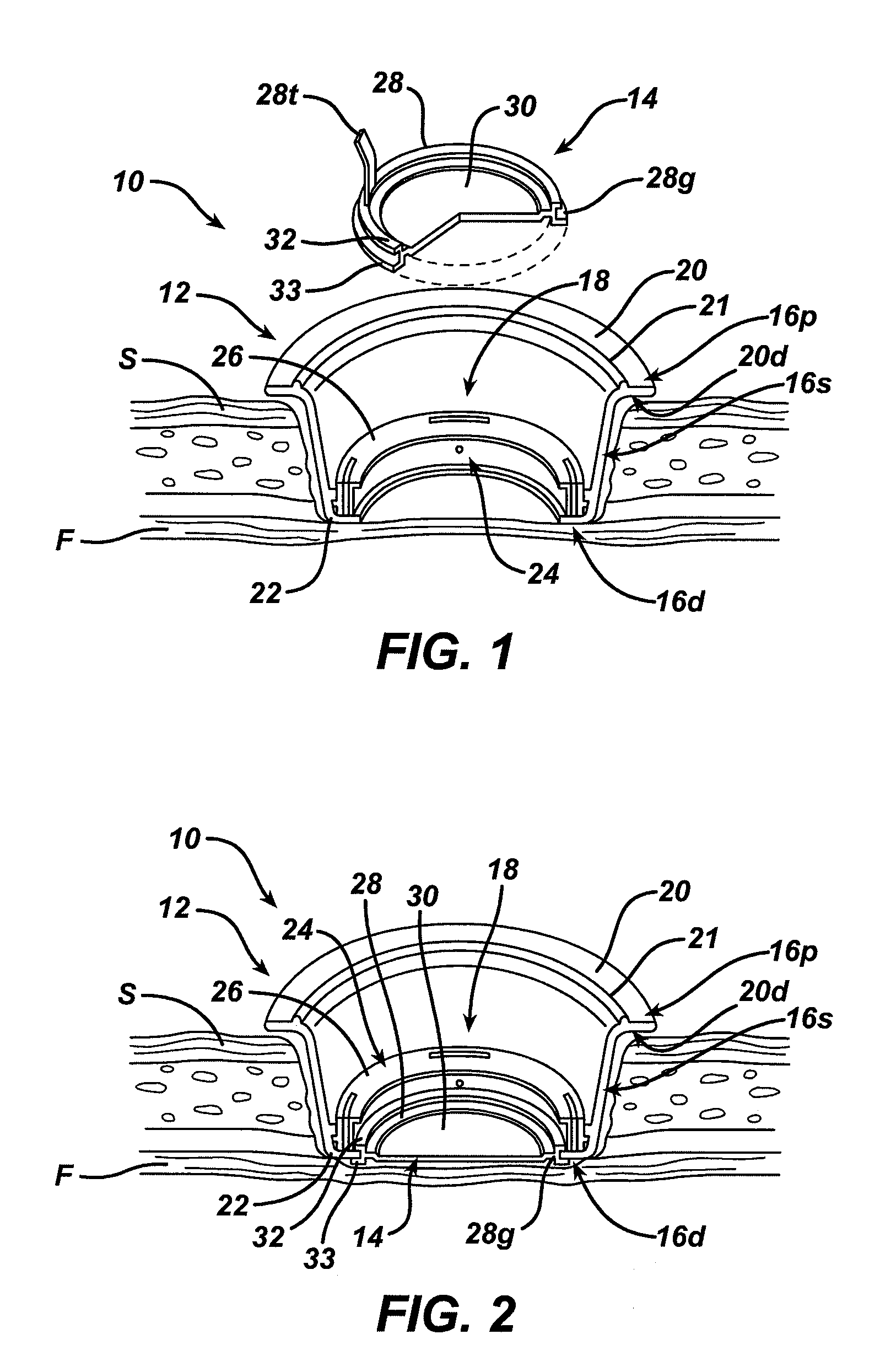 Methods and devices for accessing a body cavity using a surgical access device with modular seal components