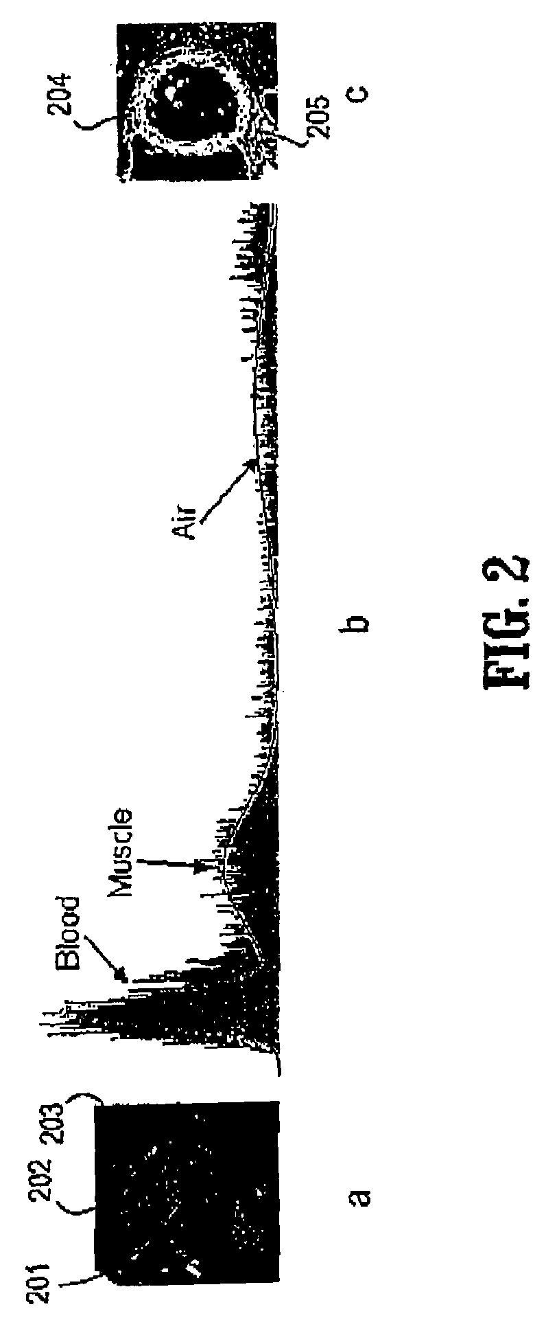 System and method for segmenting the left ventricle in a cardiac image