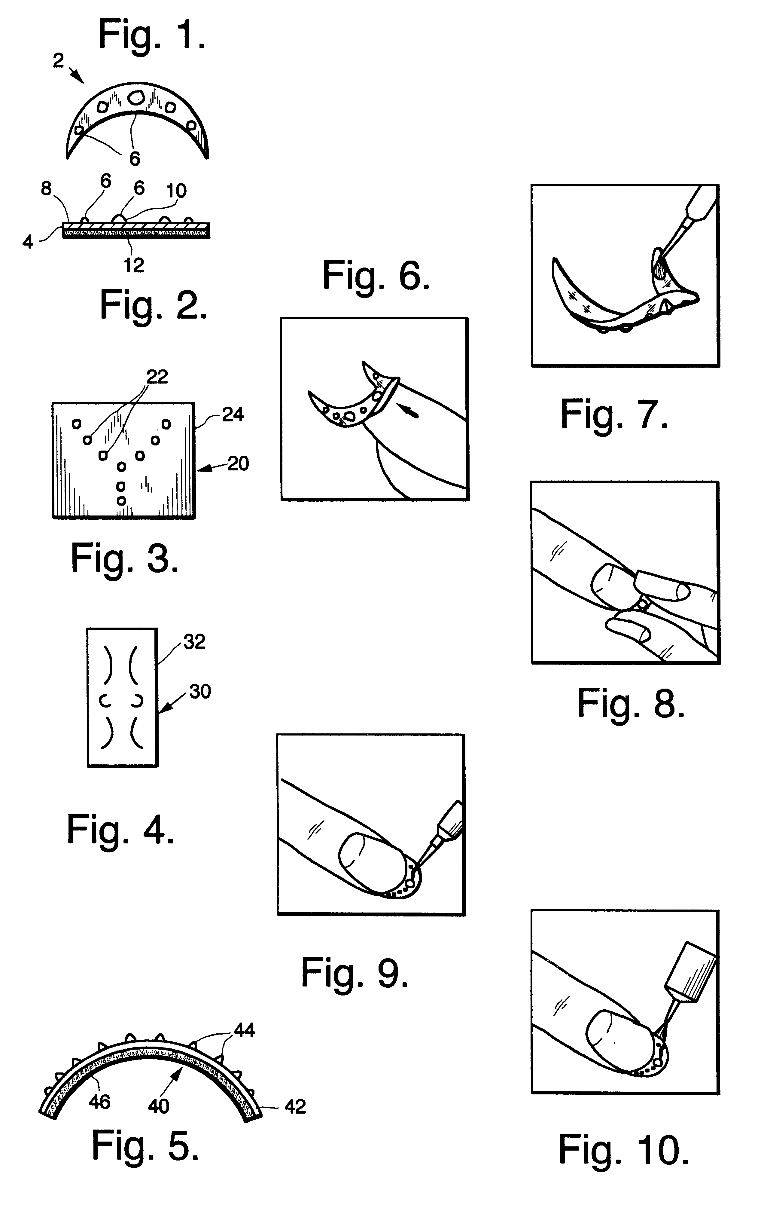 Body applique and method therefor