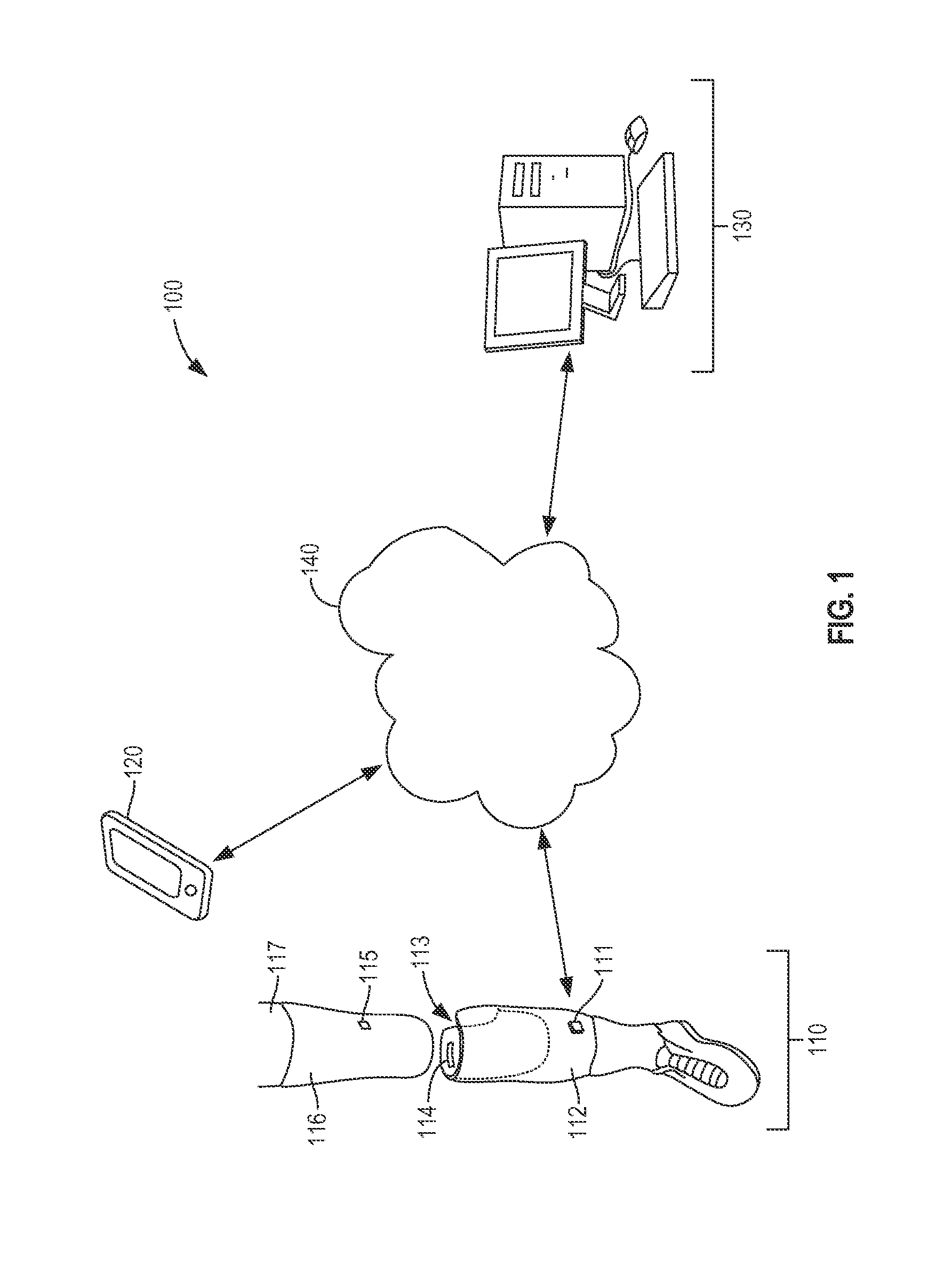 Limb volume accommodation in people with limb amputation