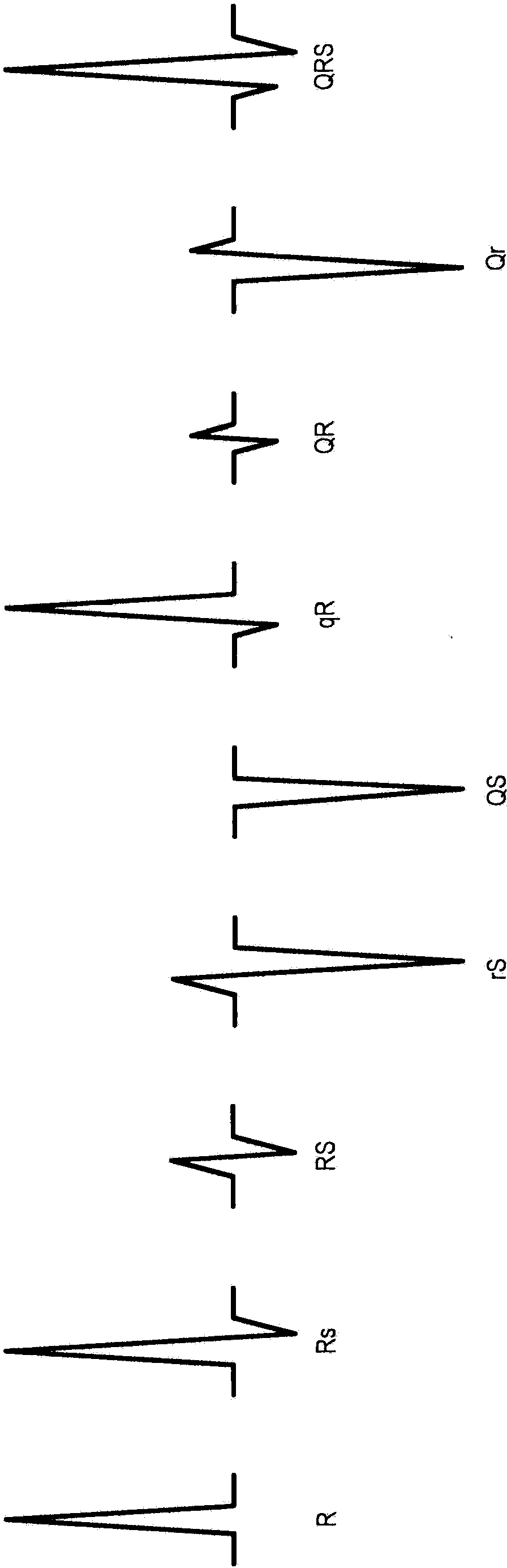 System and method for cardiac resychronization therapy control parameter generation using ventricular activation simulation and surface ECG registration