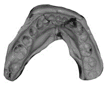 Method for acquisition of complete dentition model by computer rectification combination by sectionally taking model