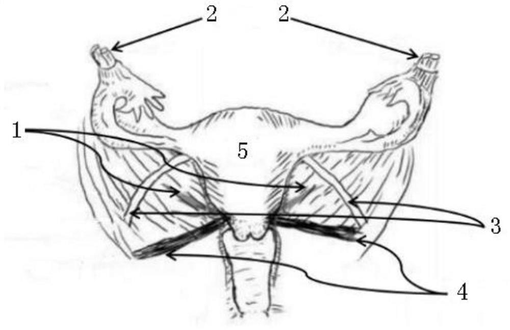 Patch for enhancing strength of human body inner sacral ligament and operation method