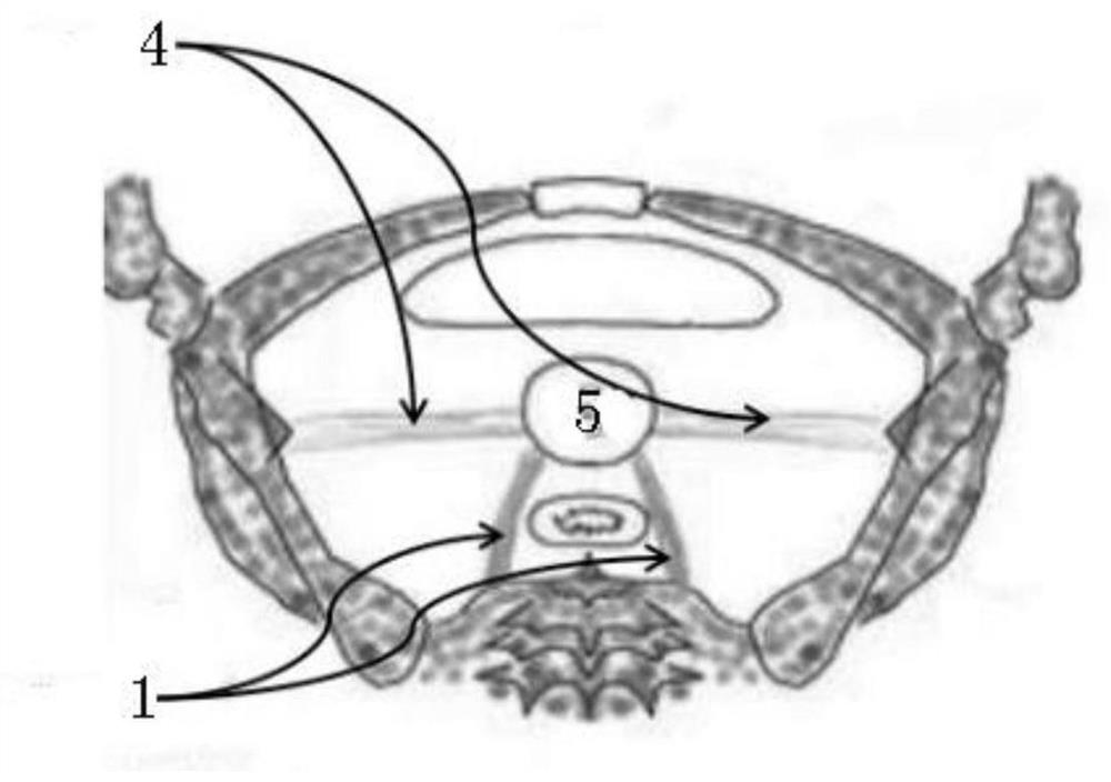 Patch for enhancing strength of human body inner sacral ligament and operation method