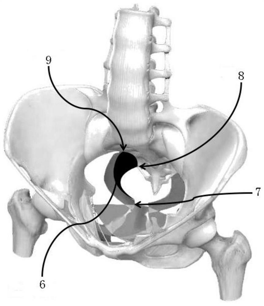 Patch for enhancing strength of human body inner sacral ligament and operation method