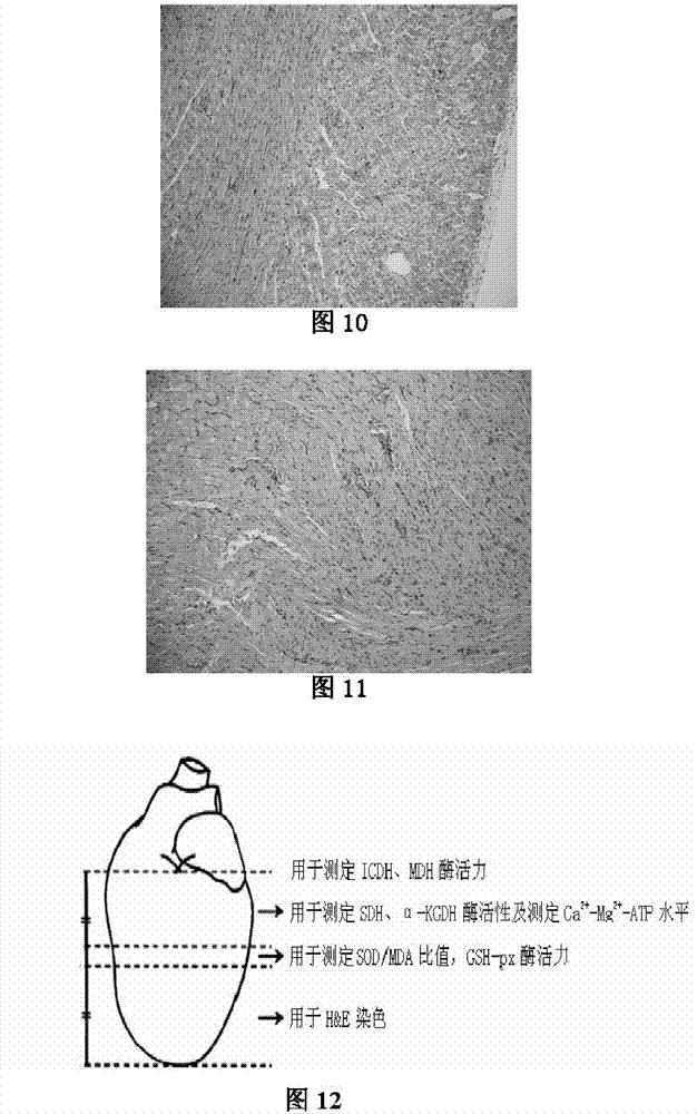 Application of allicin multilayer enteric-coated tablet to prepare medicines treating myocardial infarction disease