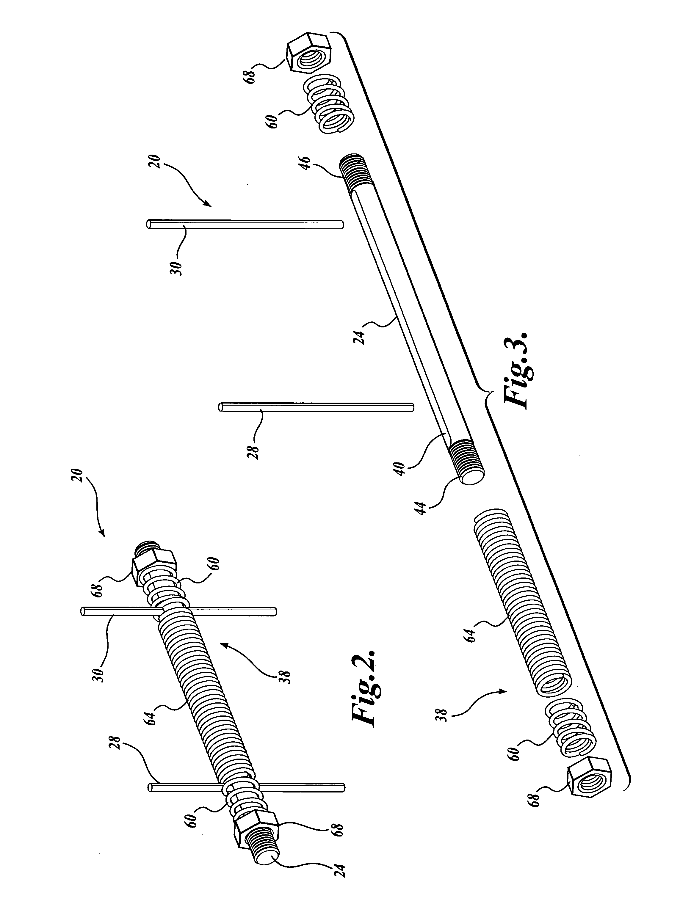 Device and method for fixing bone segments