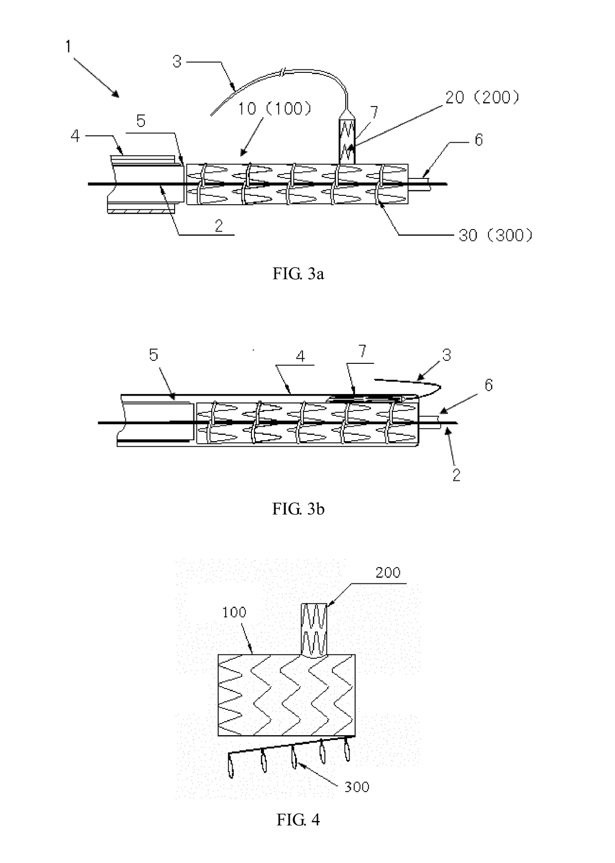 Branched stent graft, delivery system comprising same and method of fabricating same